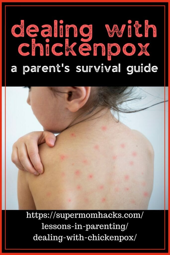 Dealing with Chickenpox (The Parent's Survival Guide) - Super Mom Hacks